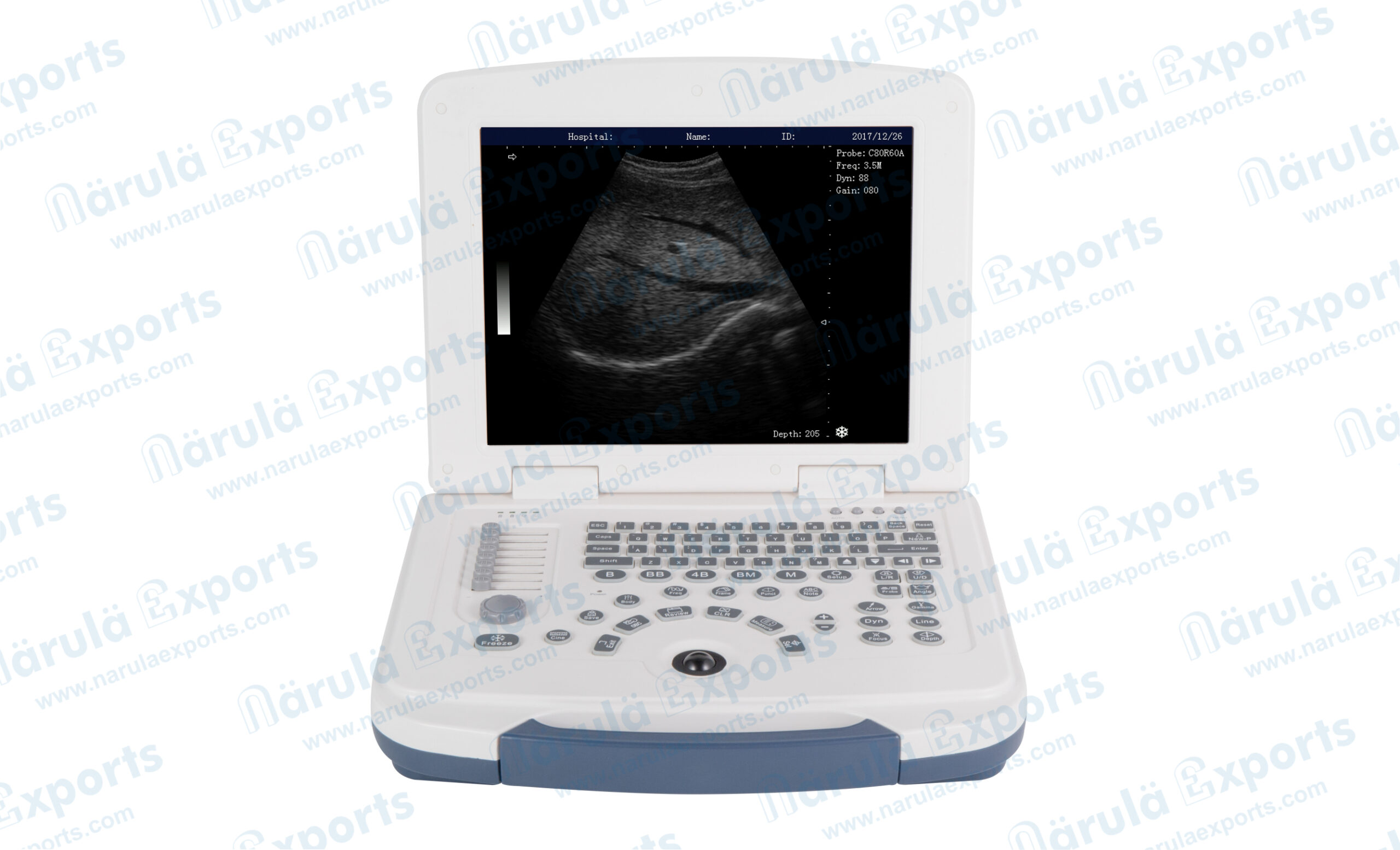 Black And White Ultrasound Machine