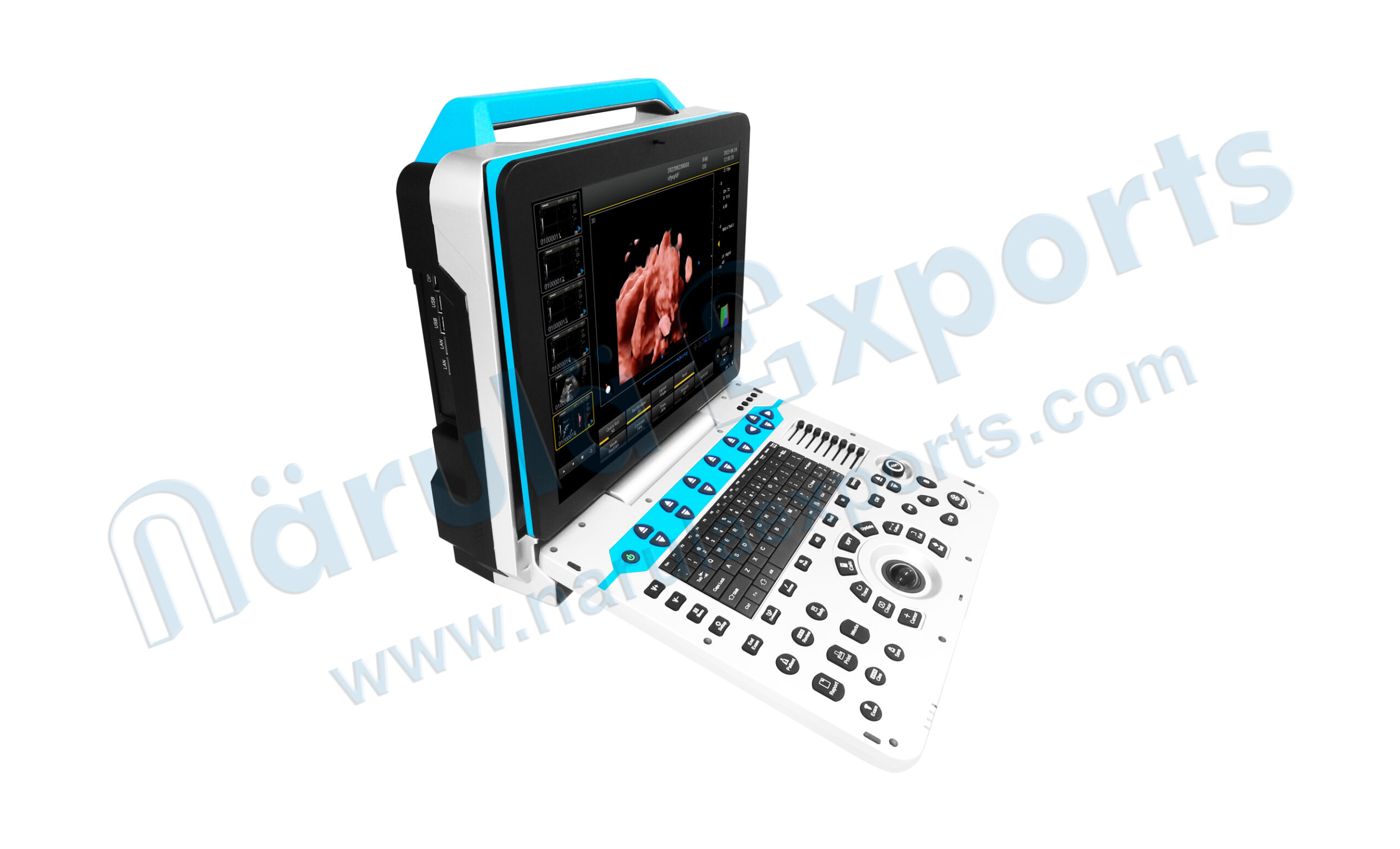 3D/4D/5D Portable Color Ultrasound System