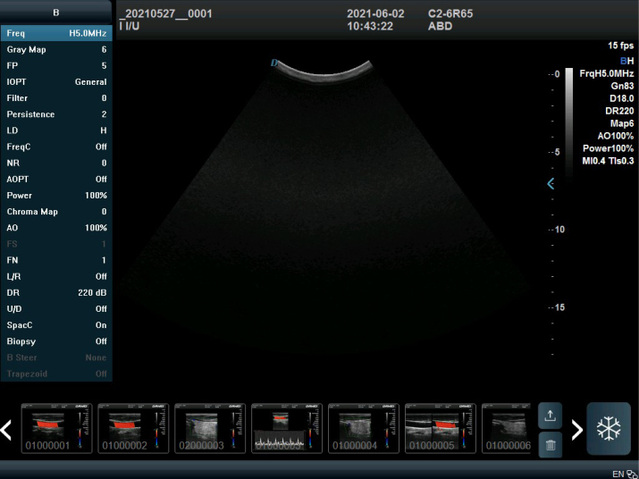 5D Ultrasound Technology Obstetric Assistant